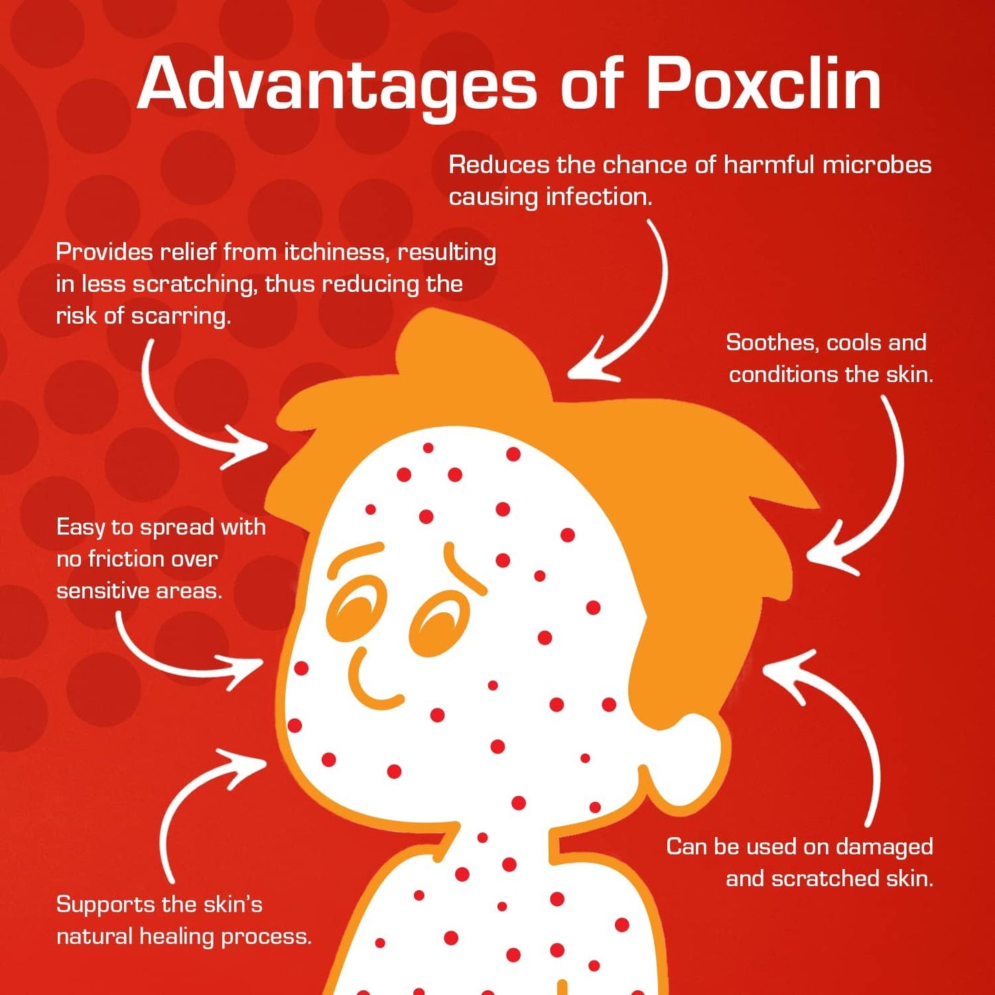 PoxClin CoolMousse for ChickenPox (100ml)